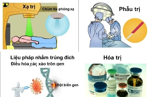 Phương pháp điều trị ung thư phổi